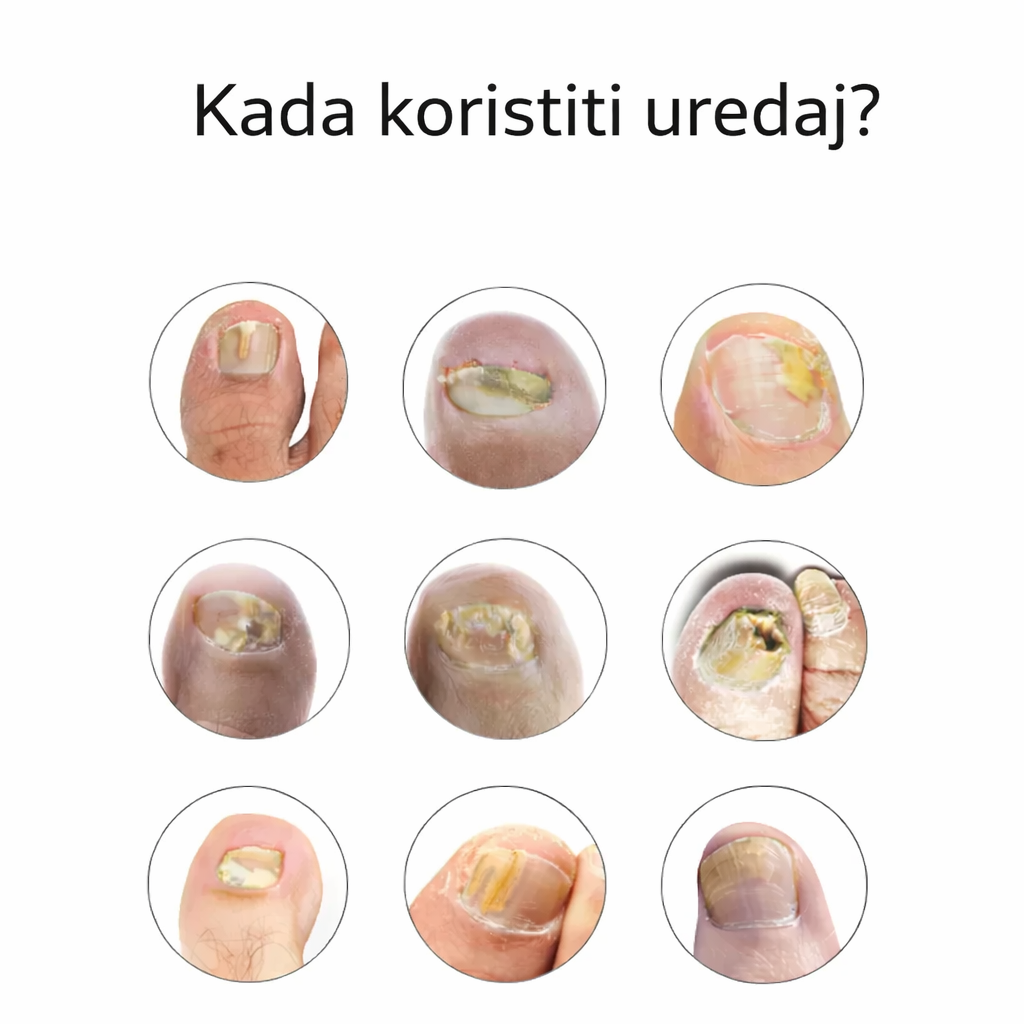 Uređaj OrthoVital